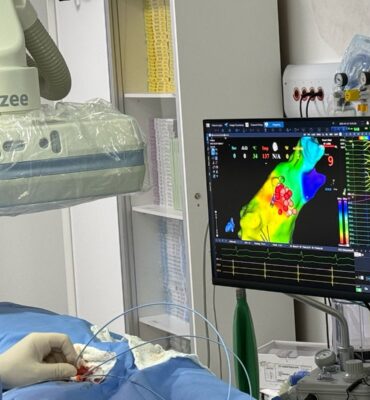 Procedimento de Ablação de Extra-Sístole Ventricular em Maceió