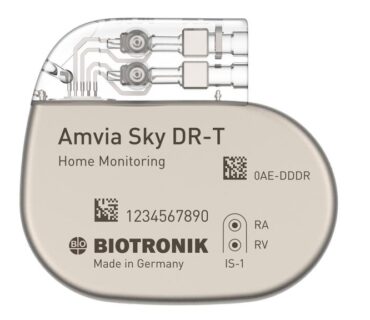 Physiological pacemaker implantation in Natal